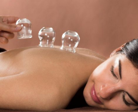 Cupping-Spa